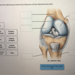 Label elbow joint anatomical features following correctly capsule ligament anterior solved transcribed problem text been show has humerus