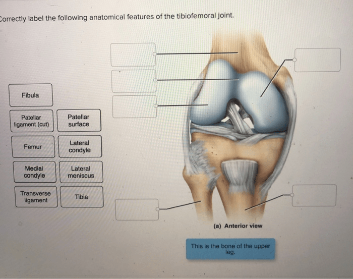 Label elbow joint anatomical features following correctly capsule ligament anterior solved transcribed problem text been show has humerus