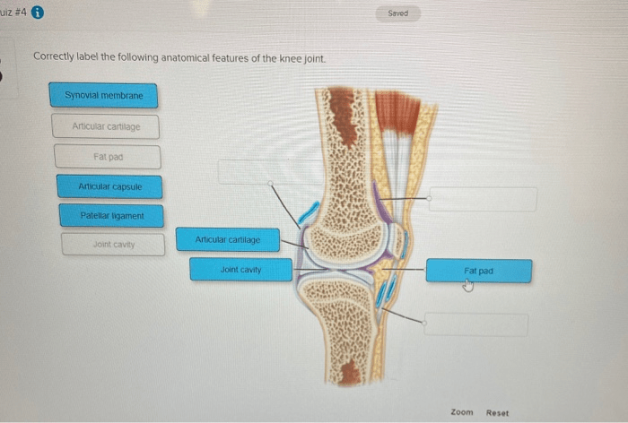 Correctly label the following anatomical features of the talocrural joint.